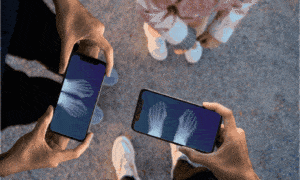 Teste pegadinha de Raio-x em 30s