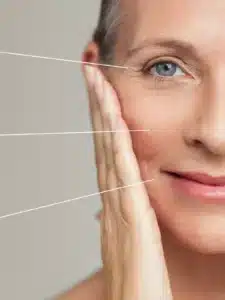 Segredos e Soluções para Rugas