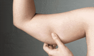 Elimine Gordurinhas no Braço: Dicas Infalíveis