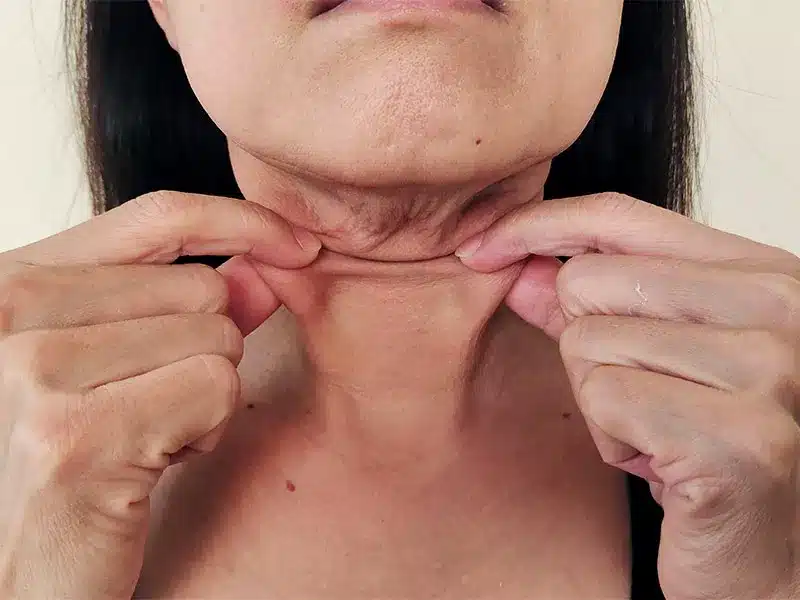 Adeus Pescoço de Peru: Dicas Noturnas
