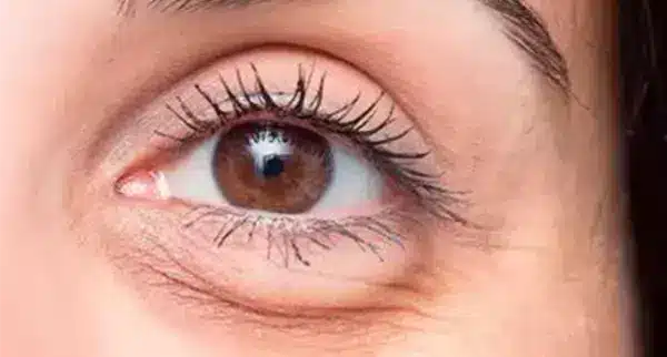 Elimine Bolsas nos Olhos Dormindo