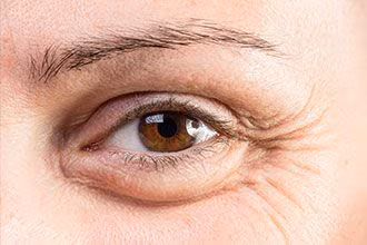 Elimine Bolsas nos Olhos Dormindo