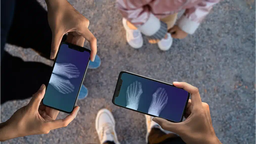 Transforme Seu Celular em Raio X