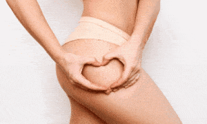 Pele Renovada: Adeus às Estrias